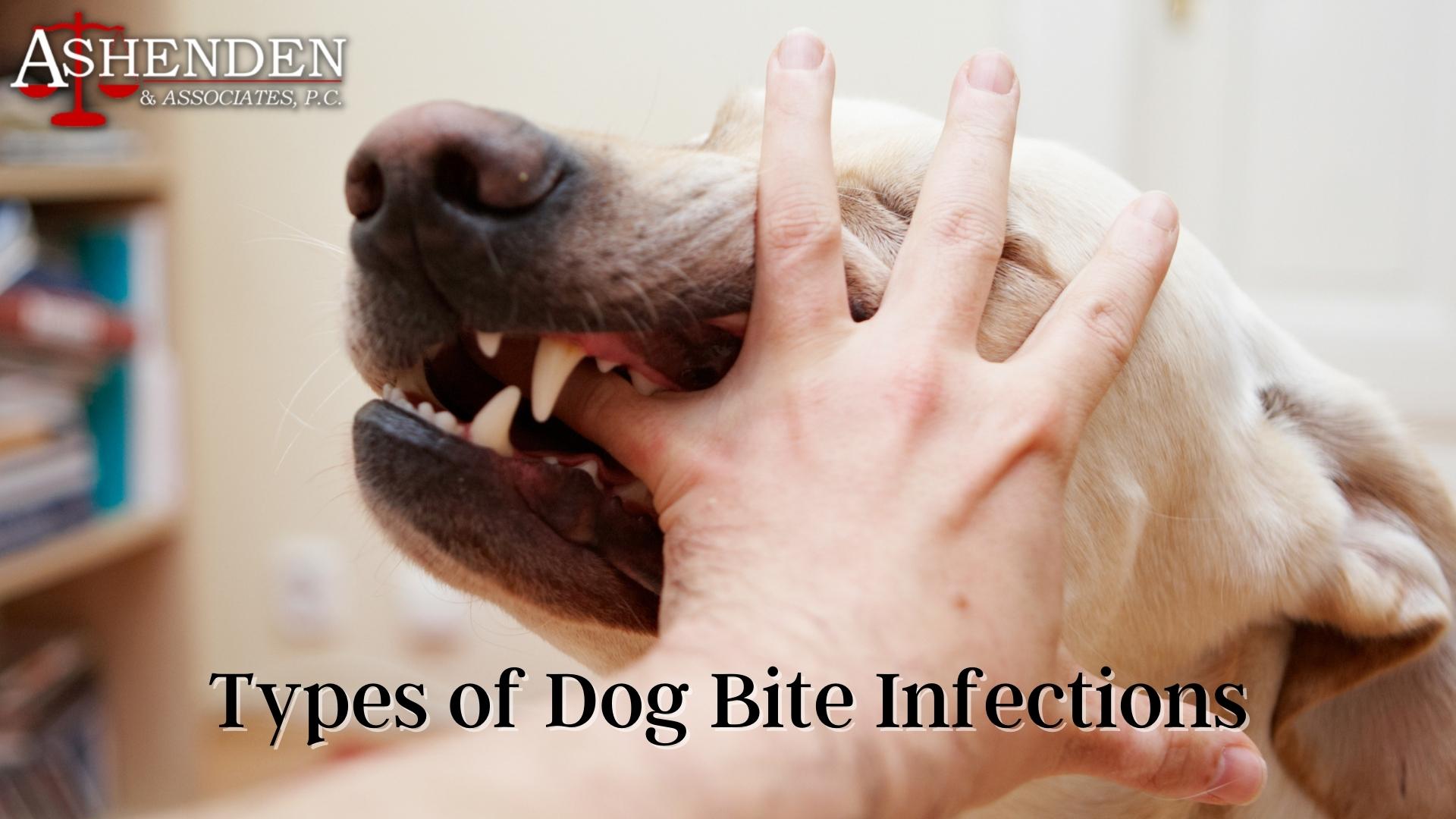 Dog Bite Hand Infection