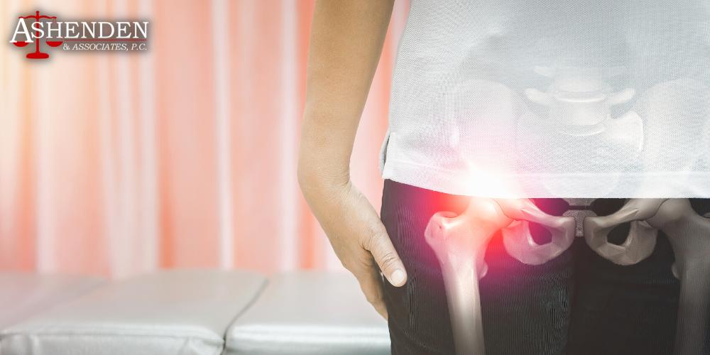depuy hip replacement recall