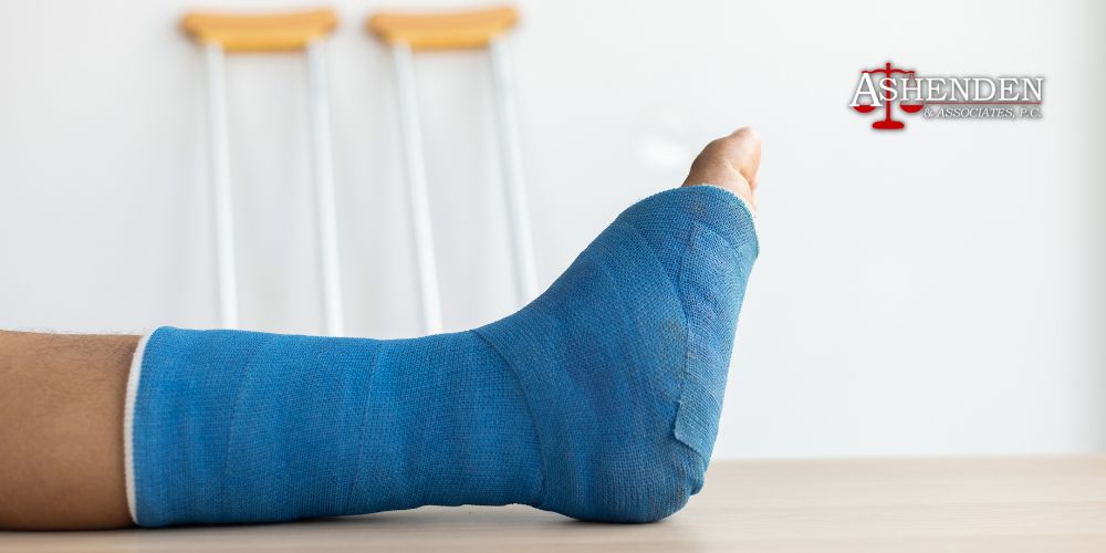 Sandy Springs Slip and Fall Lawyer