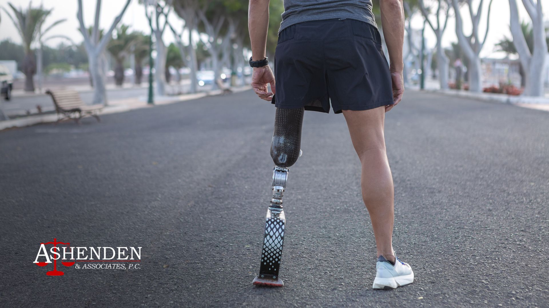 Sandy Springs Amputation Attorney