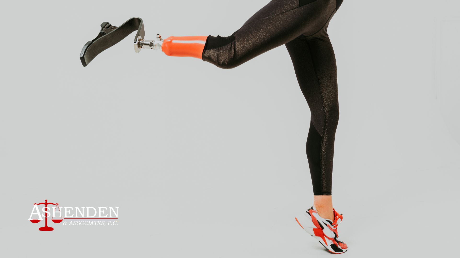 Sandy Springs Amputation Lawyer