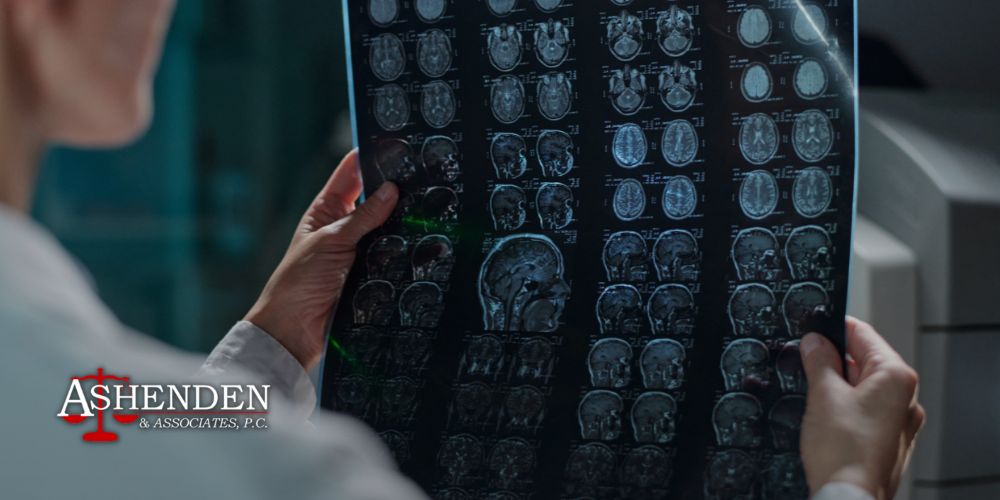 Dunwoody Georgia Brain Injury lawyer