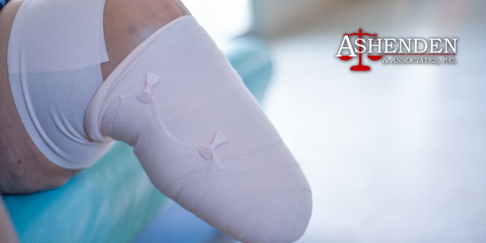 Sandy Springs and Atlanta Catastrophic Injury Attorney