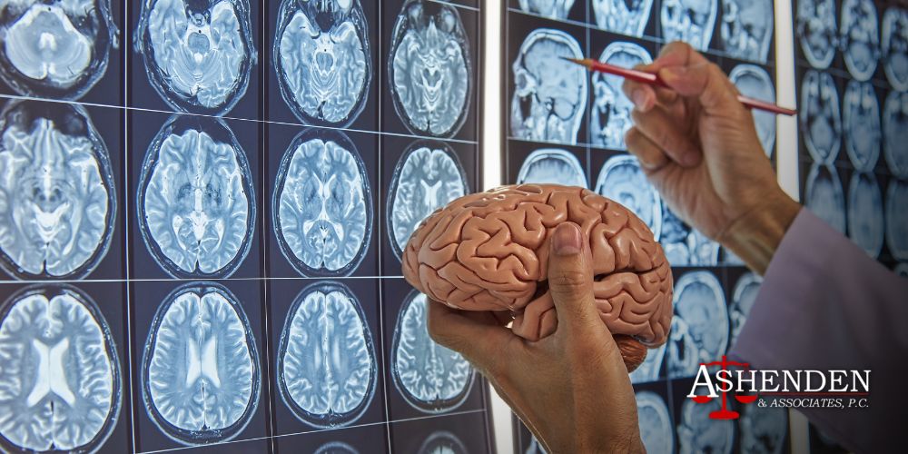 brain injury lawyer sandy springs GA