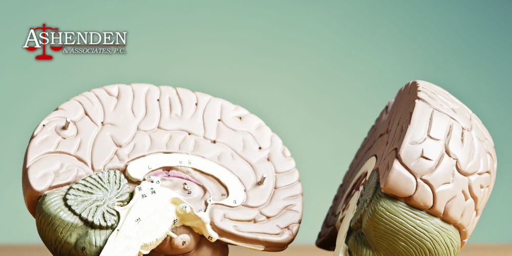 sandy springs traumatic brain injury lawyer