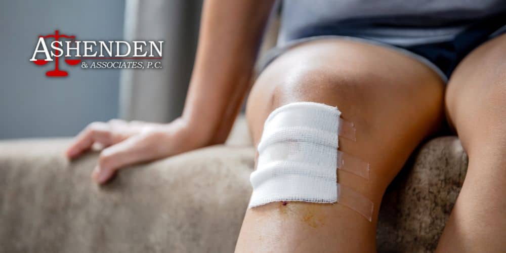 Dunwoody GA Dog Bite Lawyer